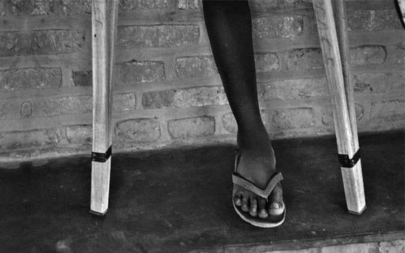Immagine che ritrae la gamba di un ragazzo insieme a due stampelle. È la foto che abbiamo scelto come simbolo per raccontare il genocidio del Rwanda